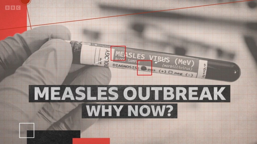 Screen shot of the title for the programme "Measles Outbreak: why now?"
